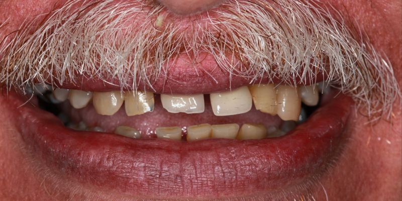 Before_After_Slide_5_Before.jpg Before_After_Slide_5_Before.jpg