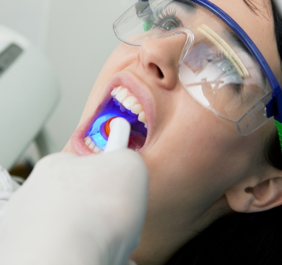 dental fillings being applied by Dr. Jensen in Kansas City
