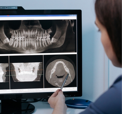 restorative dentistry in kansas city dentist showing patient X-ray