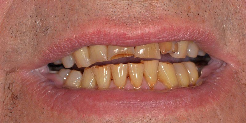 smile-gallery-4-before.jpg smile-gallery-4-before.jpg