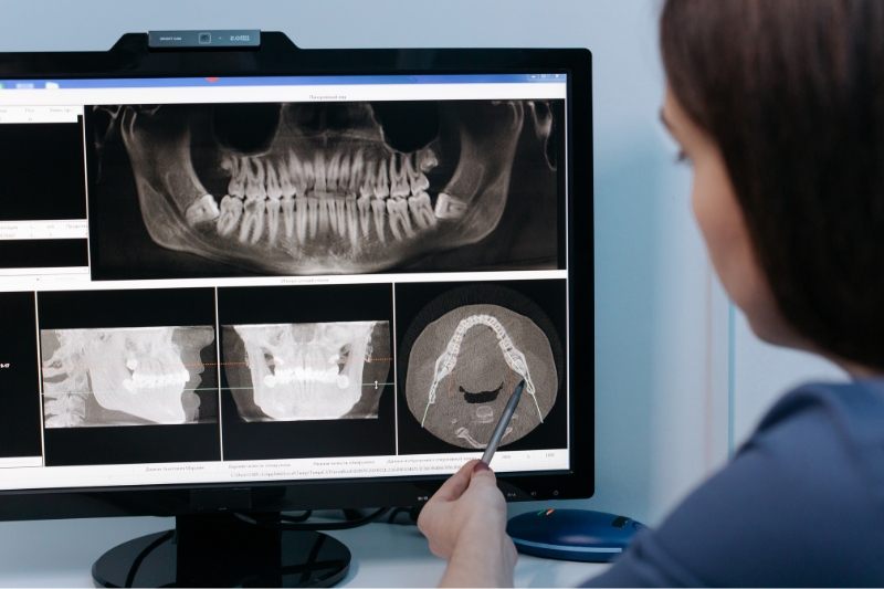 Dentist explaining same day treatment options to a patient at Staley Dental Arts.